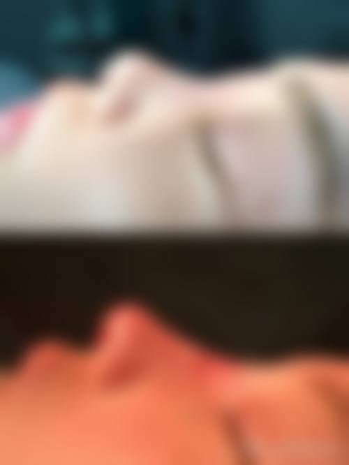 临床实例分享