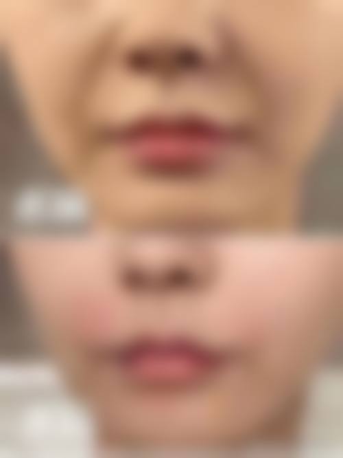 西安美人姬医疗美容门诊部擅长项目。