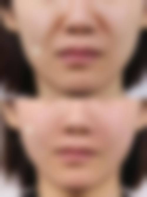 西安美人姬医疗美容门诊部2026年价格收费表：