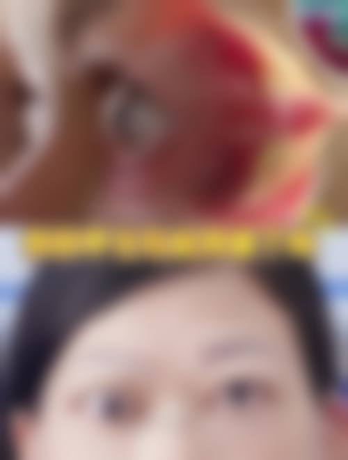 张掖市人民医院眼科擅长项目。