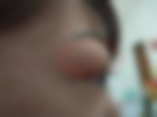 张掖市人民医院眼科治疗反馈与口碑评价。