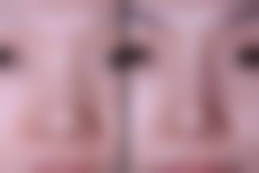 营口奉伊美医疗美容诊所擅长项目。