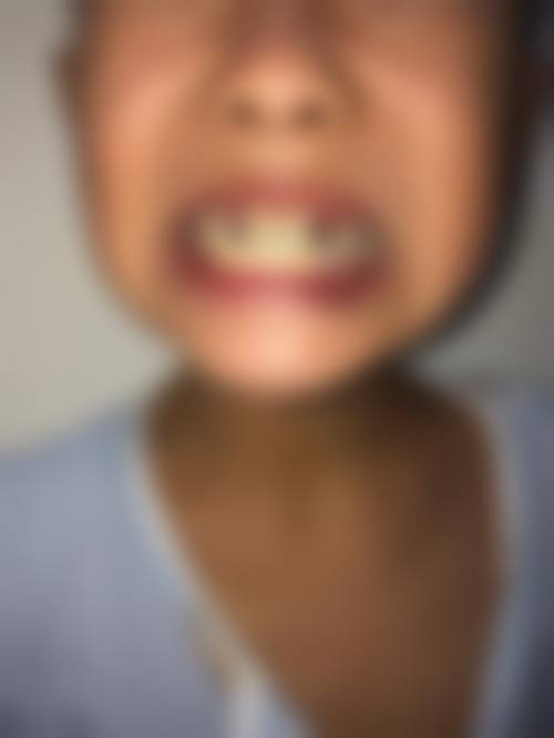 优惠活动详情:实惠看牙,不容错过