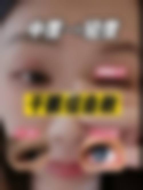 榆林爱尔眼科医院医生团队经验稳定