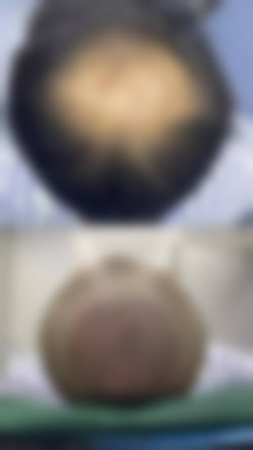 宁德华美医疗美容门诊部擅长项目。