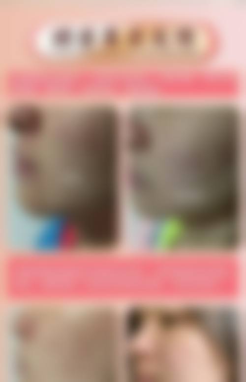 总结与预约号召:选择君珏诺颜,开启美丽蜕变