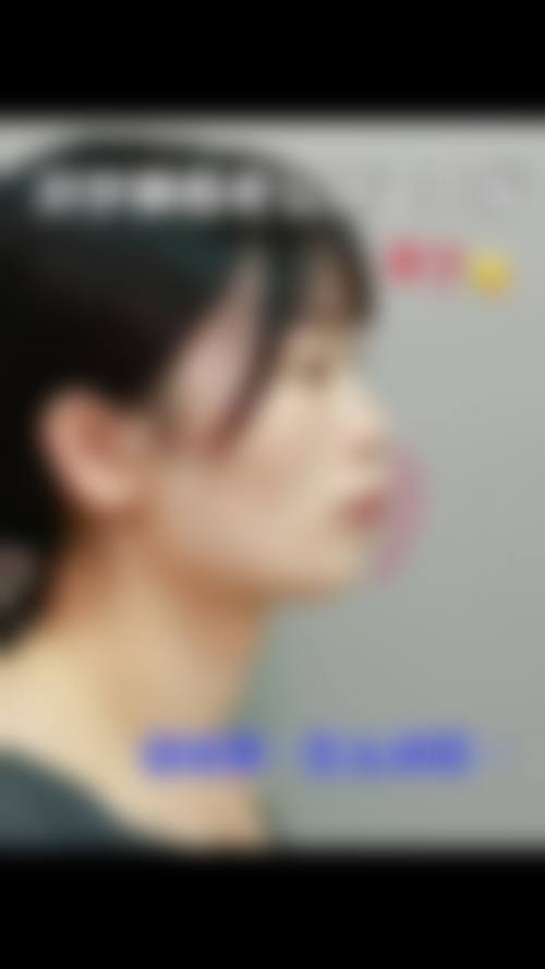 临床实例分享