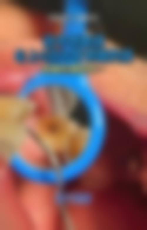 山东淄博张店贝辰口腔擅长项目。
