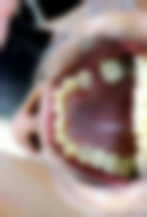 杭州博凡口腔门诊部擅长项目