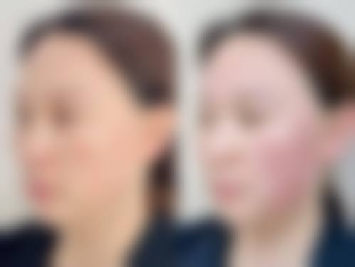 银川皓贝齿科诊所治疗反馈与口碑评价。