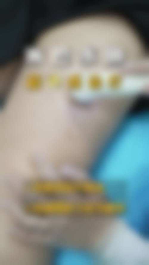 北京瑞丽舍医学美容机构医生团队经验稳定。