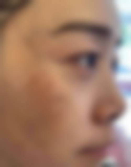 内江悦她婕熹卡医疗美容诊所擅长项目。
