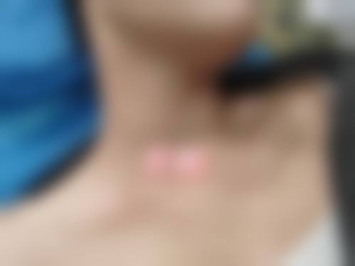 厦门华尔丽医疗美容诊所治疗反馈与口碑评价。