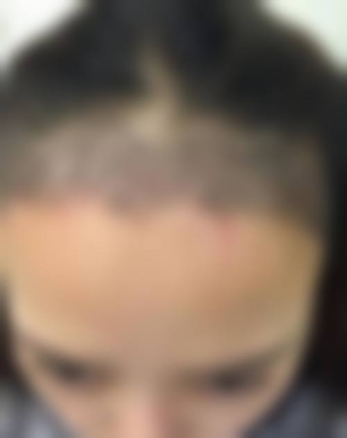 哈尔滨菲梵赛尔韦斯医疗美容门诊部治疗反馈与口碑评价。