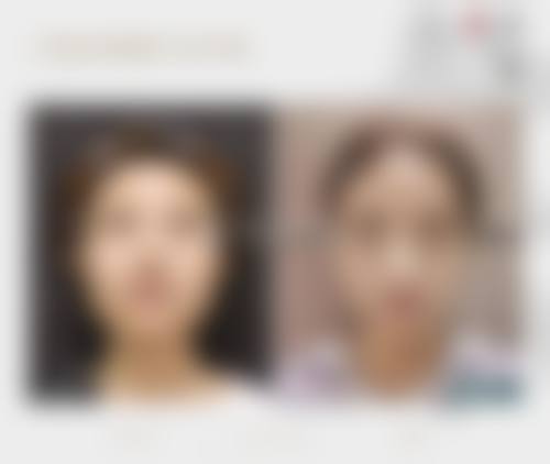 优惠活动详情与预约方式