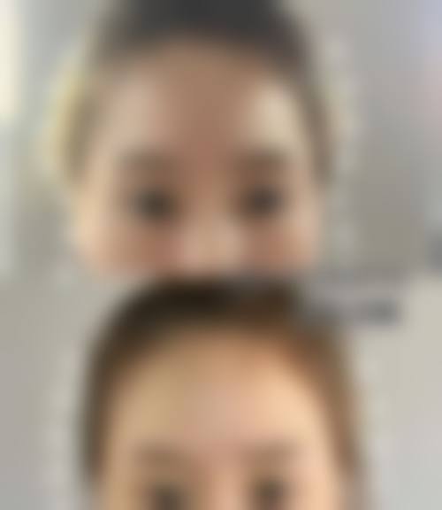 北京瑞丽舍医学美容机构擅长项目。