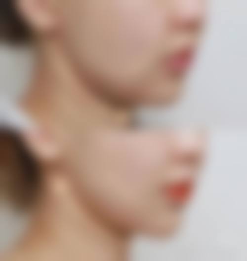 内江悦她婕熹卡医疗美容诊所治疗反馈与口碑评价。