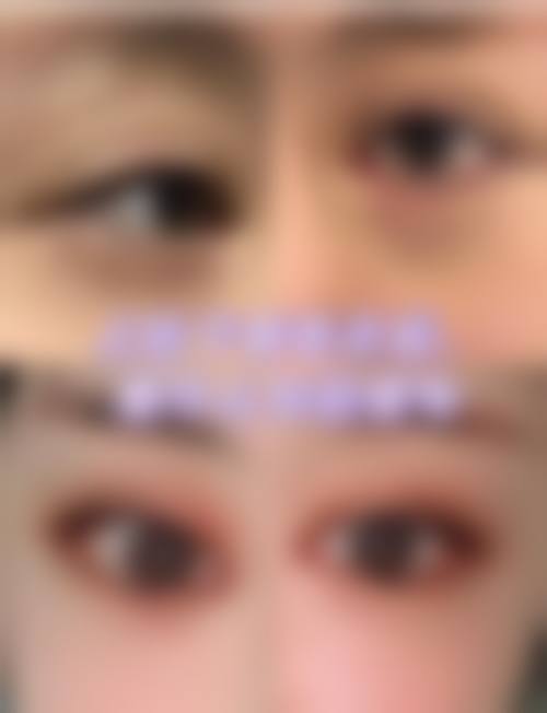 东莞艾丽尔整形医院擅长项目。