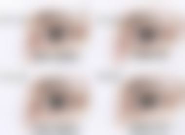 桓台县妇幼保健院眼科治疗反馈与口碑评价。