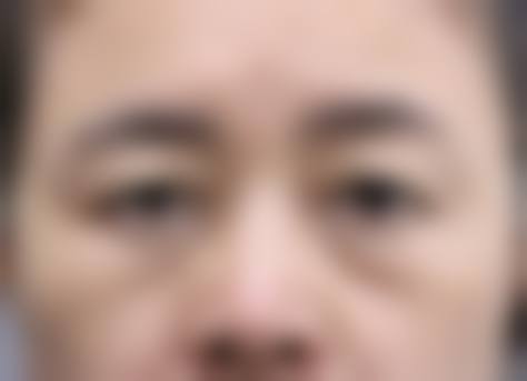 北京张宗学整形美容诊所2026年价格收费表：