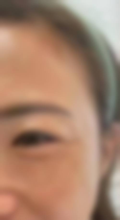 伊宁肖继玲医疗美容诊所擅长项目。