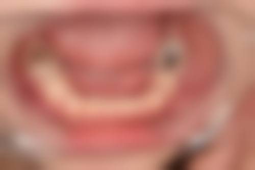 广东江门芊喜口腔治疗反馈与口碑评价。