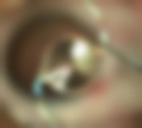 山东省妇幼保健院眼科地理位置便于到院。