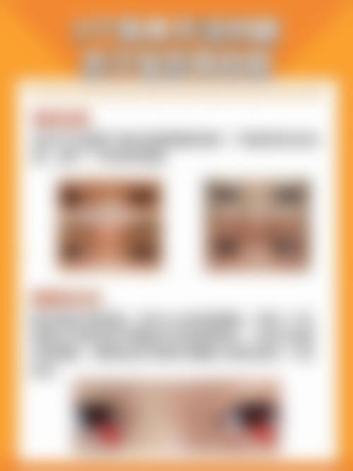 山东省妇幼保健院眼科擅长项目。