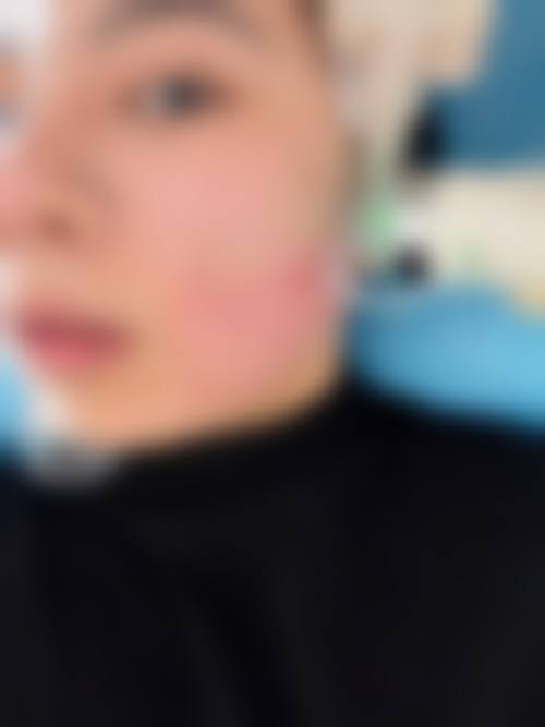 擅长项目详解
