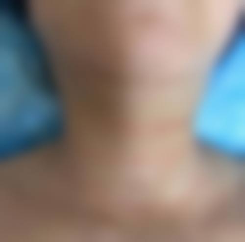 患者真实评价