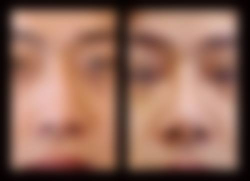临床实例分享