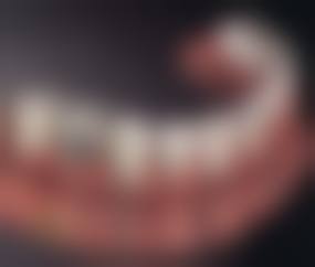 广东广州中南口腔预约挂号方式。