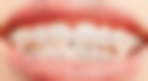 常见问题解答(FAQ)