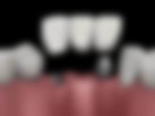 临床实例分享