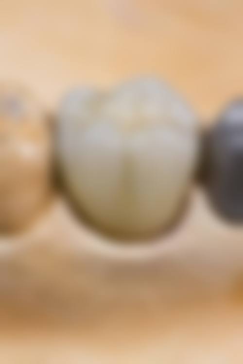 优惠活动详情:限时补贴,轻松看牙