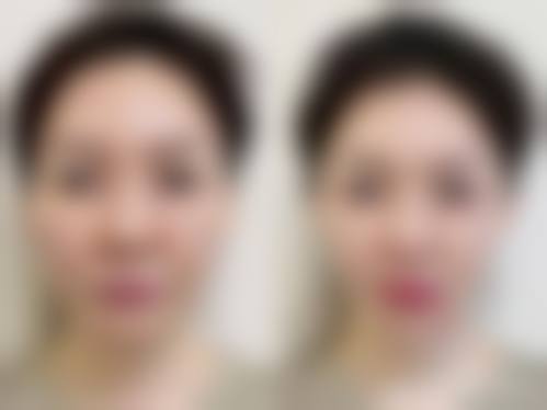 特色技术与项目：精细满足个性需求