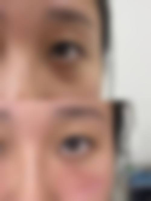 南京Adela医疗美容医院治疗反馈与口碑评价。