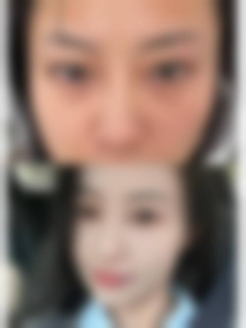 擅长项目详解