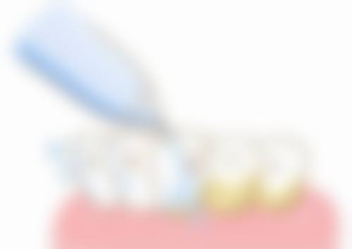 合肥瑞特曼口腔医院口碑评价