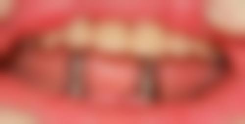 武汉百川贝诺口腔门诊部预约挂号方式。