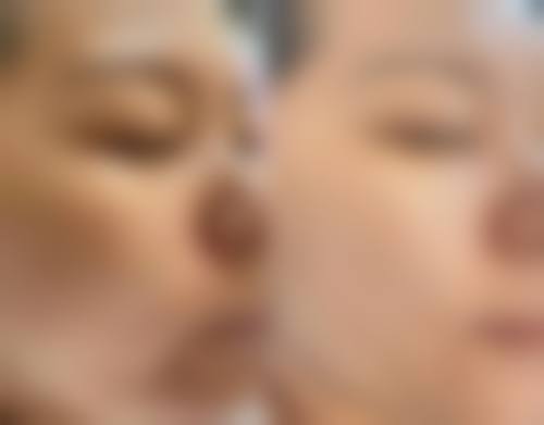 擅长项目详解