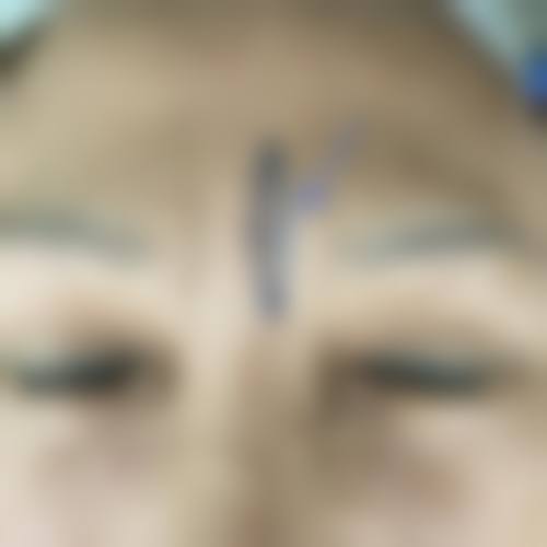 郴州市美科整形擅长项目。