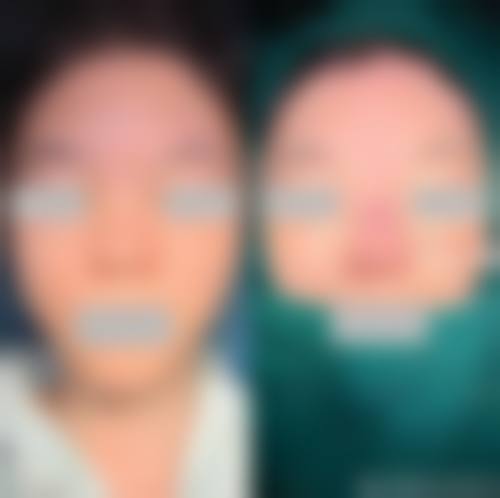 成都玉之光整形美容医院治疗反馈与口碑评价。