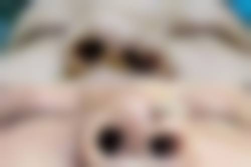 临床实例分享
