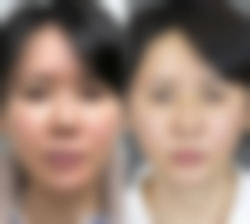 擅长项目详解