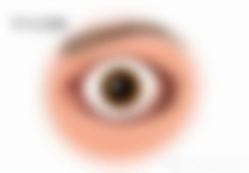 特色项目与个性化诊疗——精细解决眼病困扰