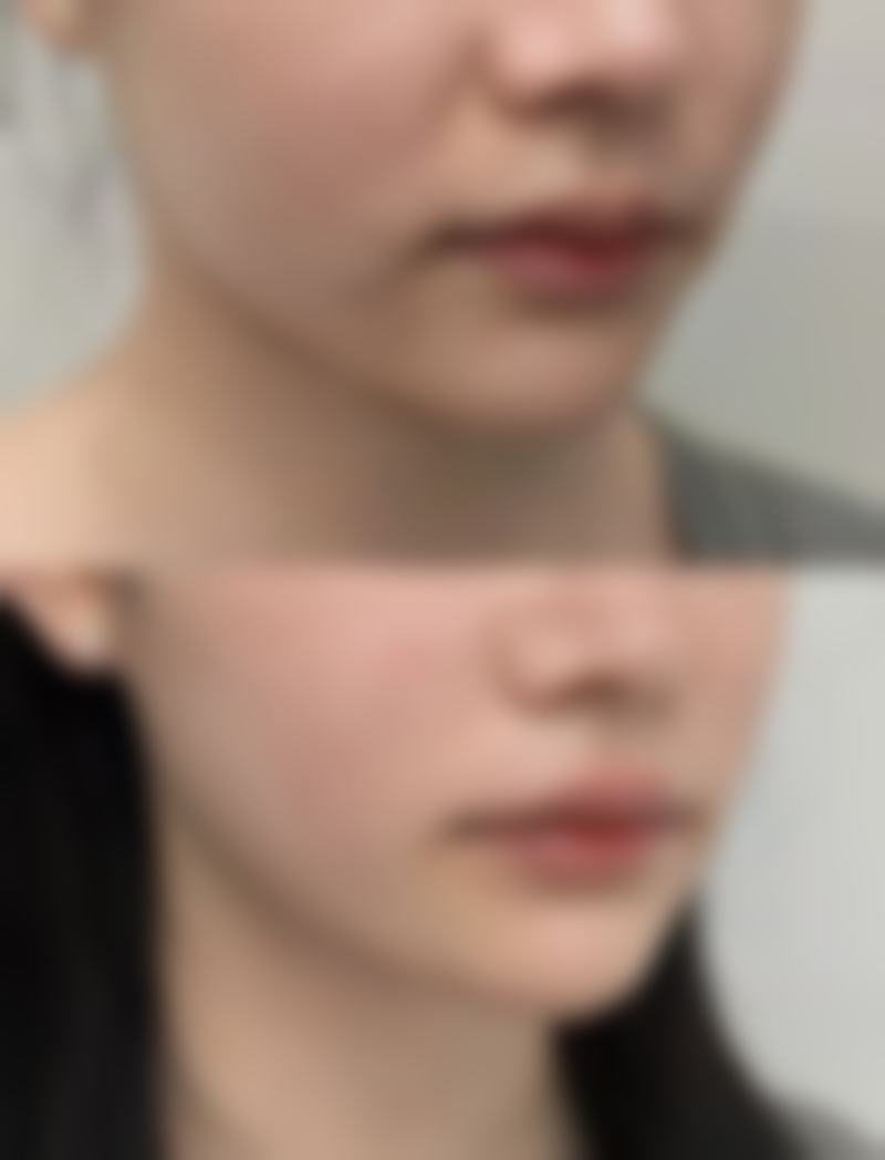广比利次擅长项目解读