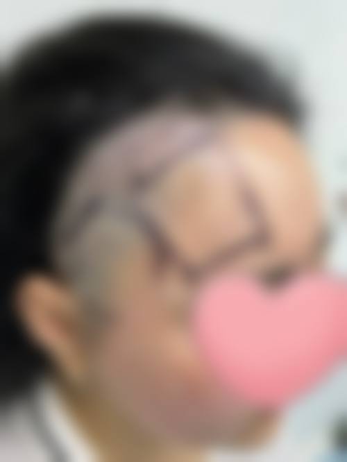 广州嘉悦整形医院治疗反馈与口碑评价