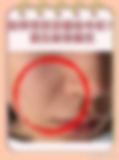 潍坊海大星范整形医院预约挂号方式。