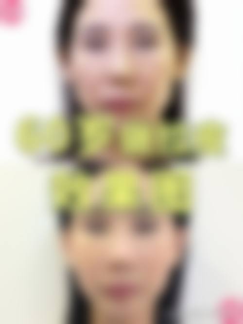 潍坊海大星范整形医院治疗反馈与口碑评价。